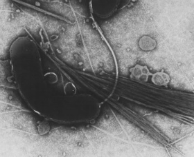 A black and white image taken with an electron microscope shows a kidney-shaped Vibrio cholerae bacterium